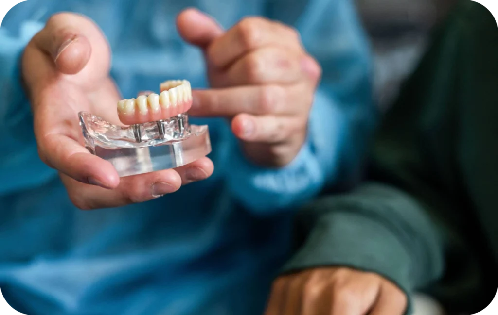 all on solution edentement villeneuve d ascq All on 4 / All on 6 Chirurgiens-dentistes | Villeneuve d’Ascq près de Lille