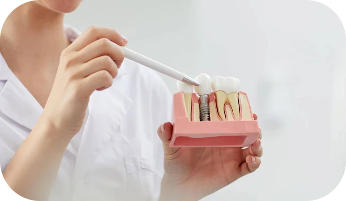 Implant dentaire