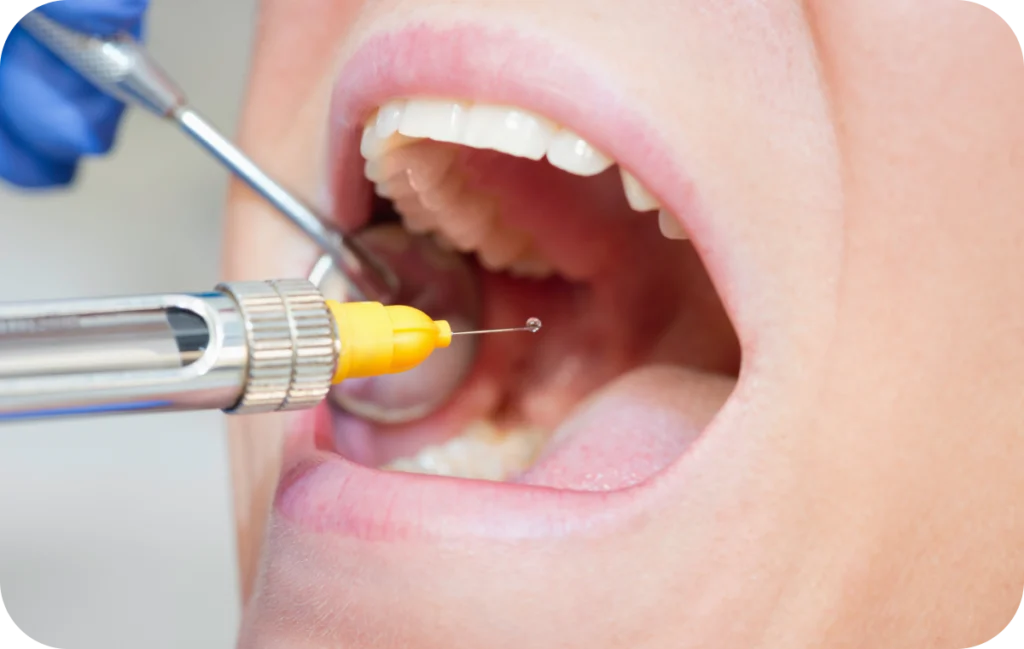 anesthesie dentaire villeneuve d ascq Conseils pré-opératoires Chirurgiens-dentistes | Villeneuve d’Ascq près de Lille