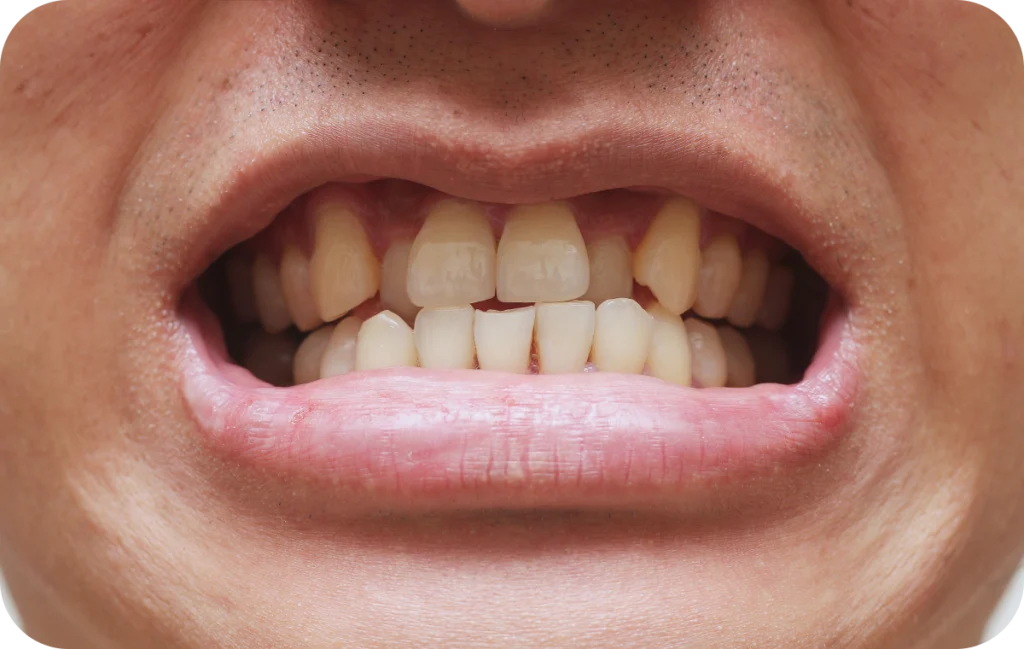 appareils dentaires repositionnement dents villeneuve d ascq Orthodontie Chirurgiens-dentistes | Villeneuve d’Ascq près de Lille