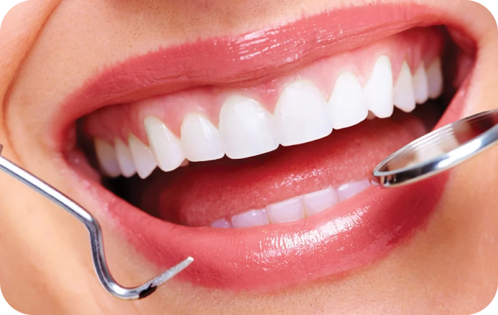 dentisterie esthetique correction defauts villeneuve d ascq Soins des gencives  Chirurgiens-dentistes | Villeneuve d’Ascq près de Lille