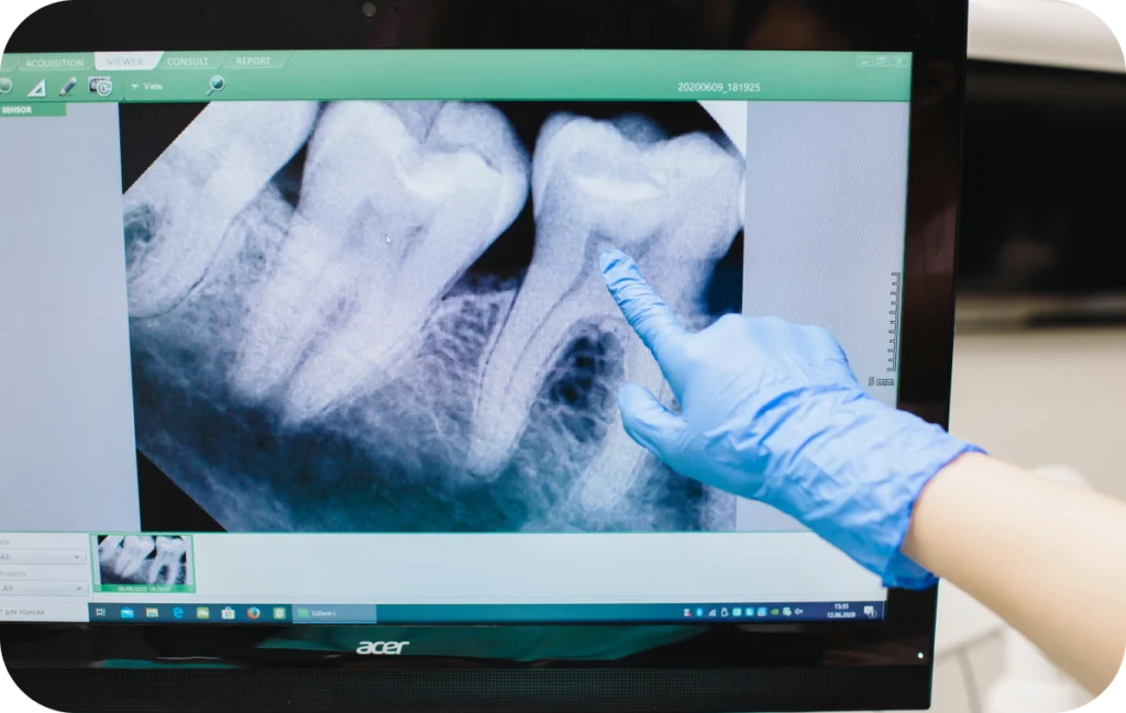 eclaircissement dentaire sourire lumineux villeneuve d ascq Endodontie Chirurgiens-dentistes | Villeneuve d’Ascq près de Lille