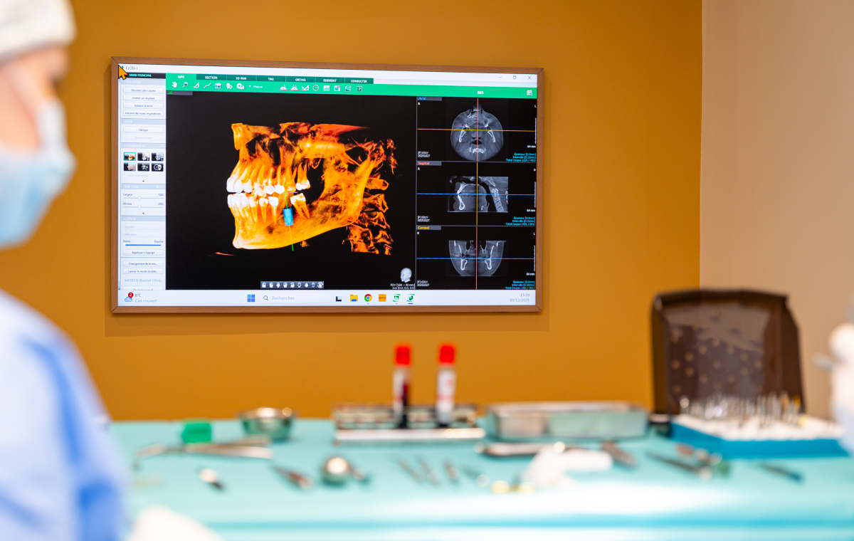 Implants dentaires : les bonnes pratiques