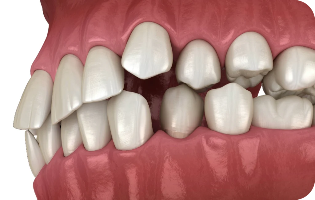 soins gencives hygiene buccale villeneuve d ascq Occlusodontie Chirurgiens-dentistes | Villeneuve d’Ascq près de Lille