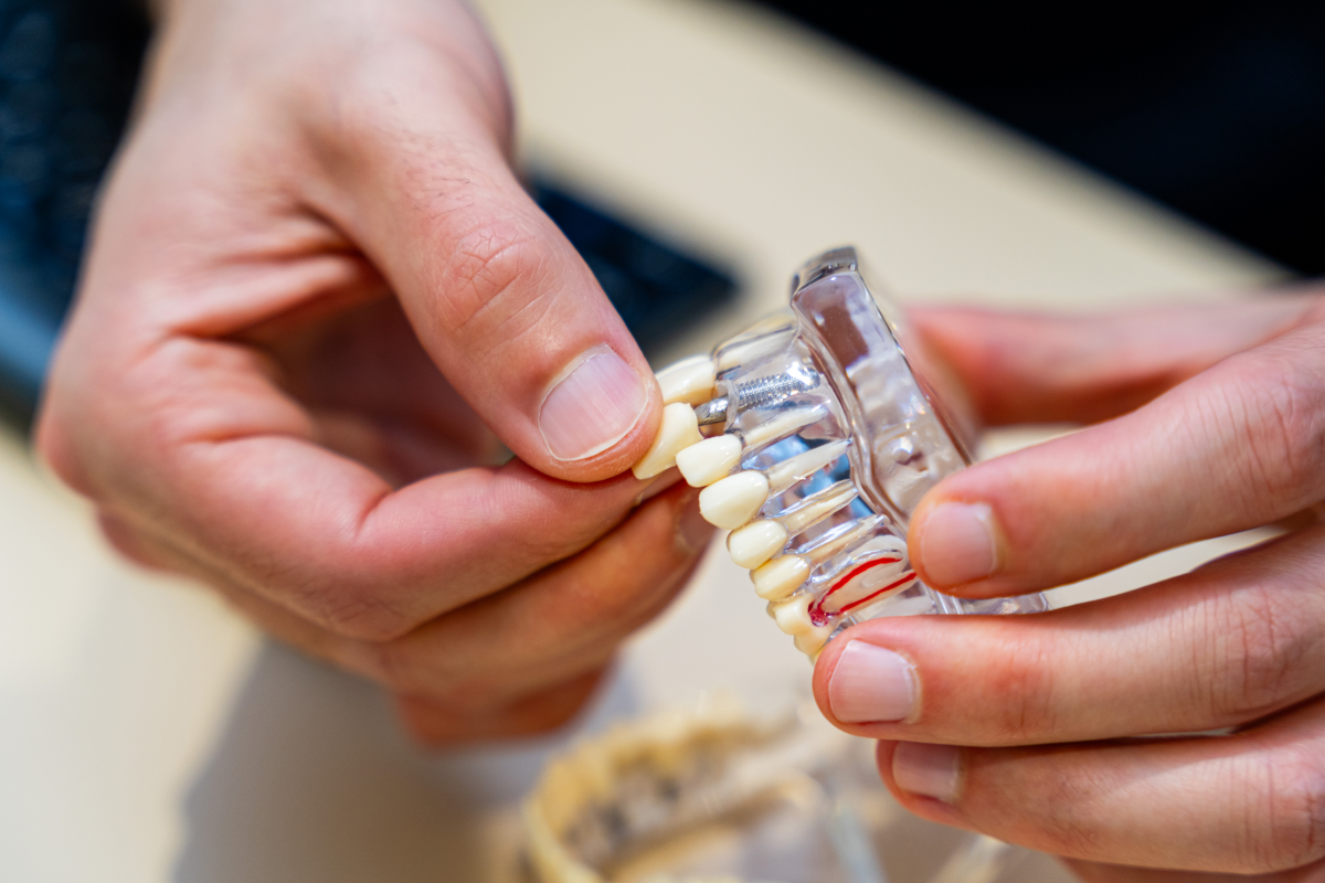 mxl implant unitaire remplacement dent villeneuve d ascq  Chirurgiens-dentistes | Villeneuve d’Ascq près de Lille